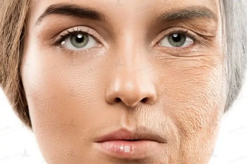 تغییرات چهره بعد از ترک سیگار